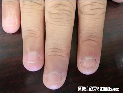 剪指甲、挖耳屎,这些日常小动作竟隐藏大危害! - 日照生活资讯 - 日照28生活网 rizhao.28life.com